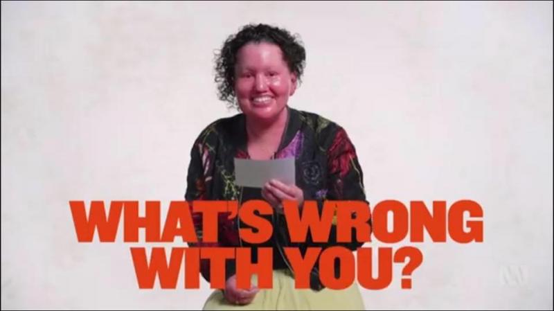 Carly Findlay on the set of the show smiles at the camera and holds a card that asks the question, "What wrong with you?"