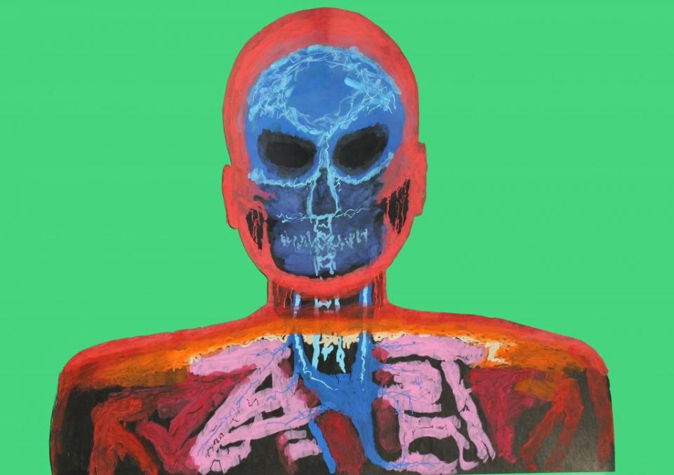 MRI, by Graham Naylor, showing as part of an exhibition by brain injury survivors