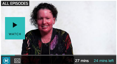 You cant ask that on Facial Differences - ABC live